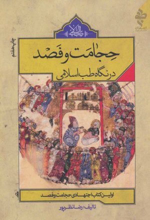 حجامت و فصد در نگاه اسلامی